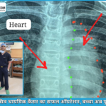 11 वर्षीय बच्चे के दिल से चिपका दुर्लभ कैंसर निकालकर अम्बेडकर अस्पताल ने रचा इतिहास